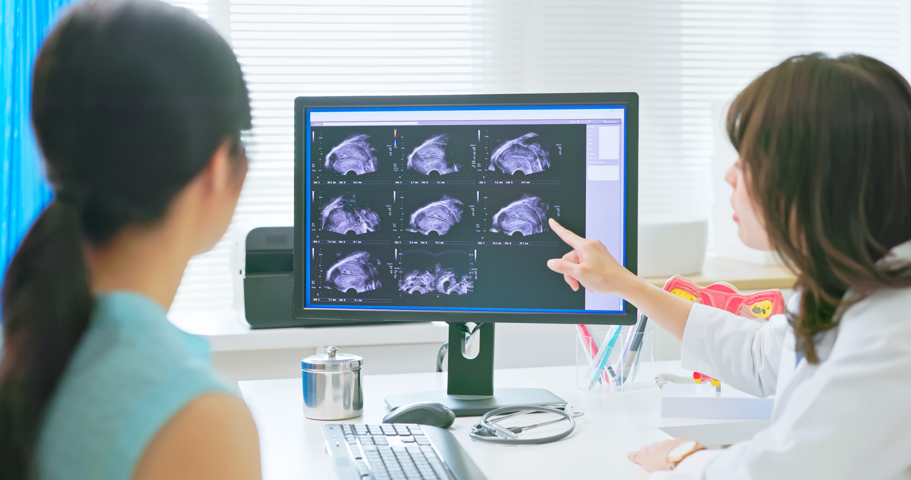 cáncer cervicouterino