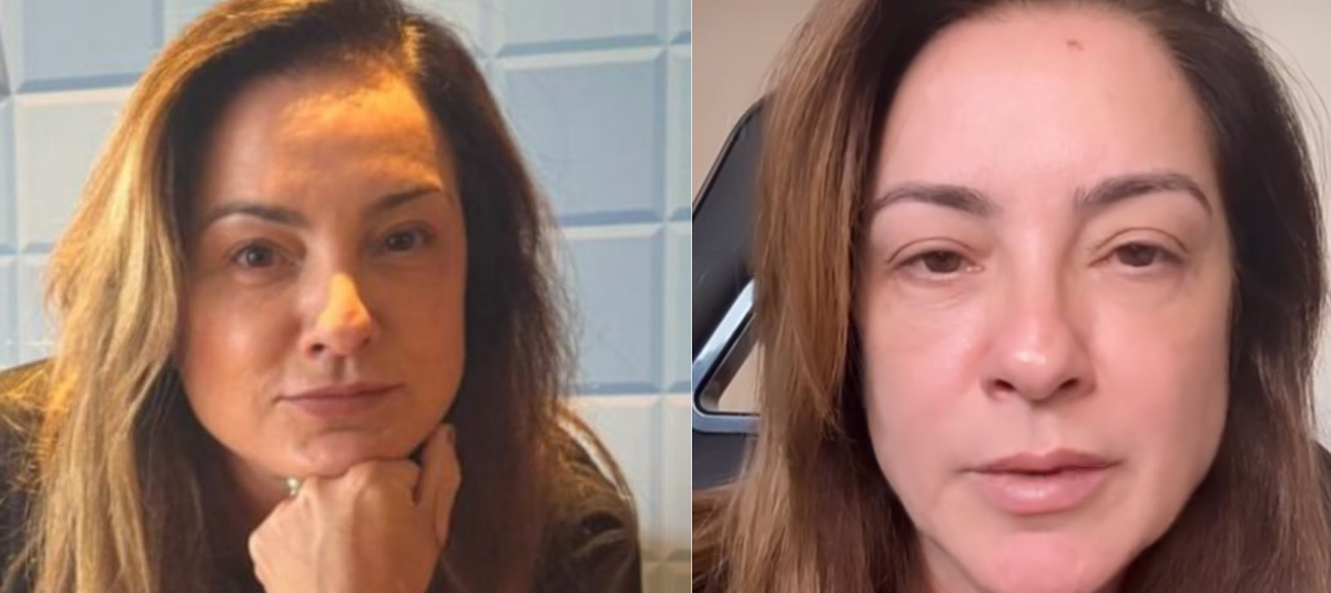 En el lado derecho puede observar la marca que la alertó.