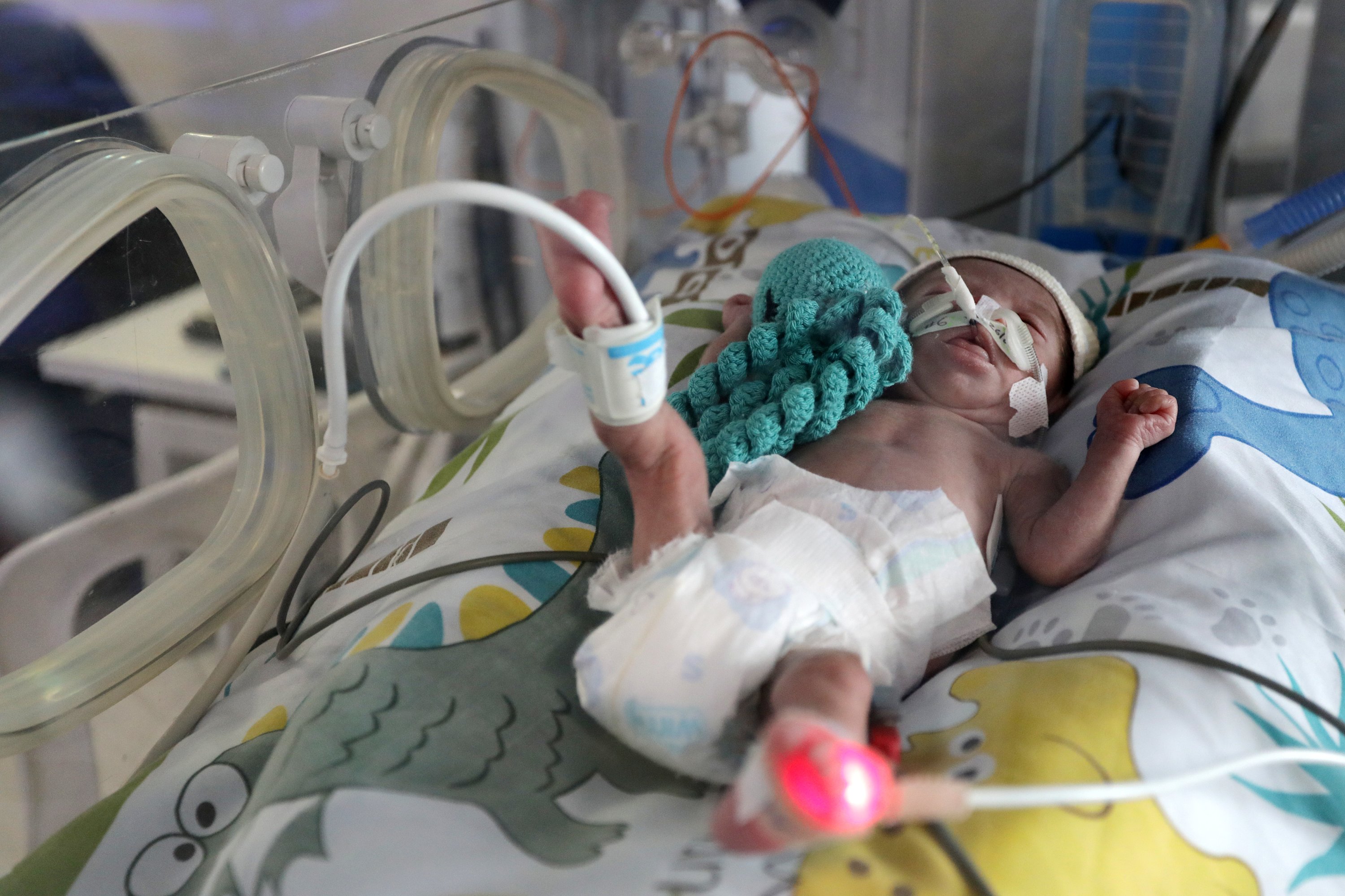 Bogotá 27 de Junio 2025
En la unidad de neonatología del hospital Meissen de Bogotá (Ciudad Bolívar) los bebés prematuros duermen con peluches de pulpos dentro de sus incubadoras. Este tratamiento humaniza el vínculo a la madre en el proceso del neonato.
Foto: César Melgarejo/ El Tiempo @melgarejocesarnew
Crédito: CEET Fotógrafo: CESAR MELGAREJO