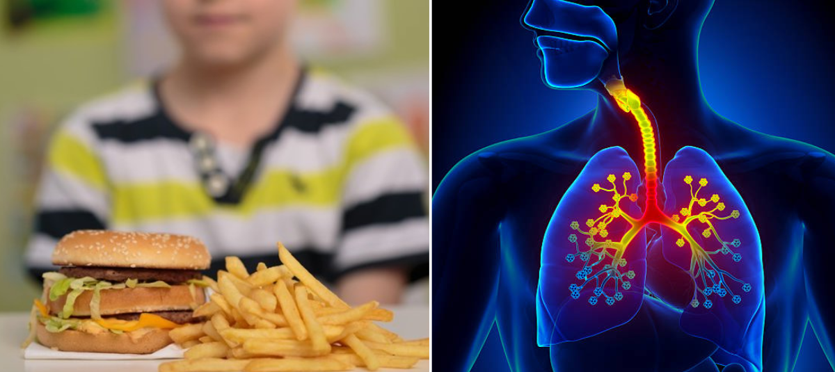 Comer alimentos ultraprocesados en la niñez aumentaría 30 % el riesgo de padecer enfermedades respiratorias en la adultez, dice estudio