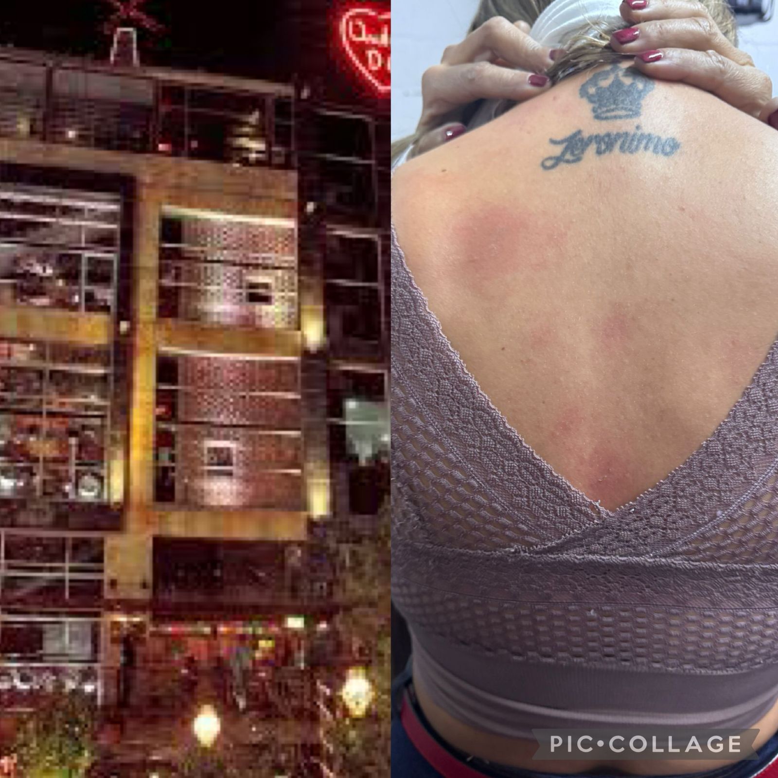 Muchos clientes Terminaron Con Su Ropa y Piel Quemada.