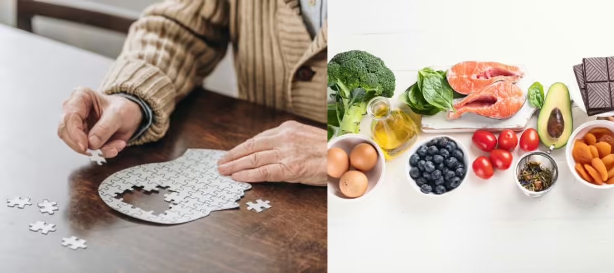 Alimentación
