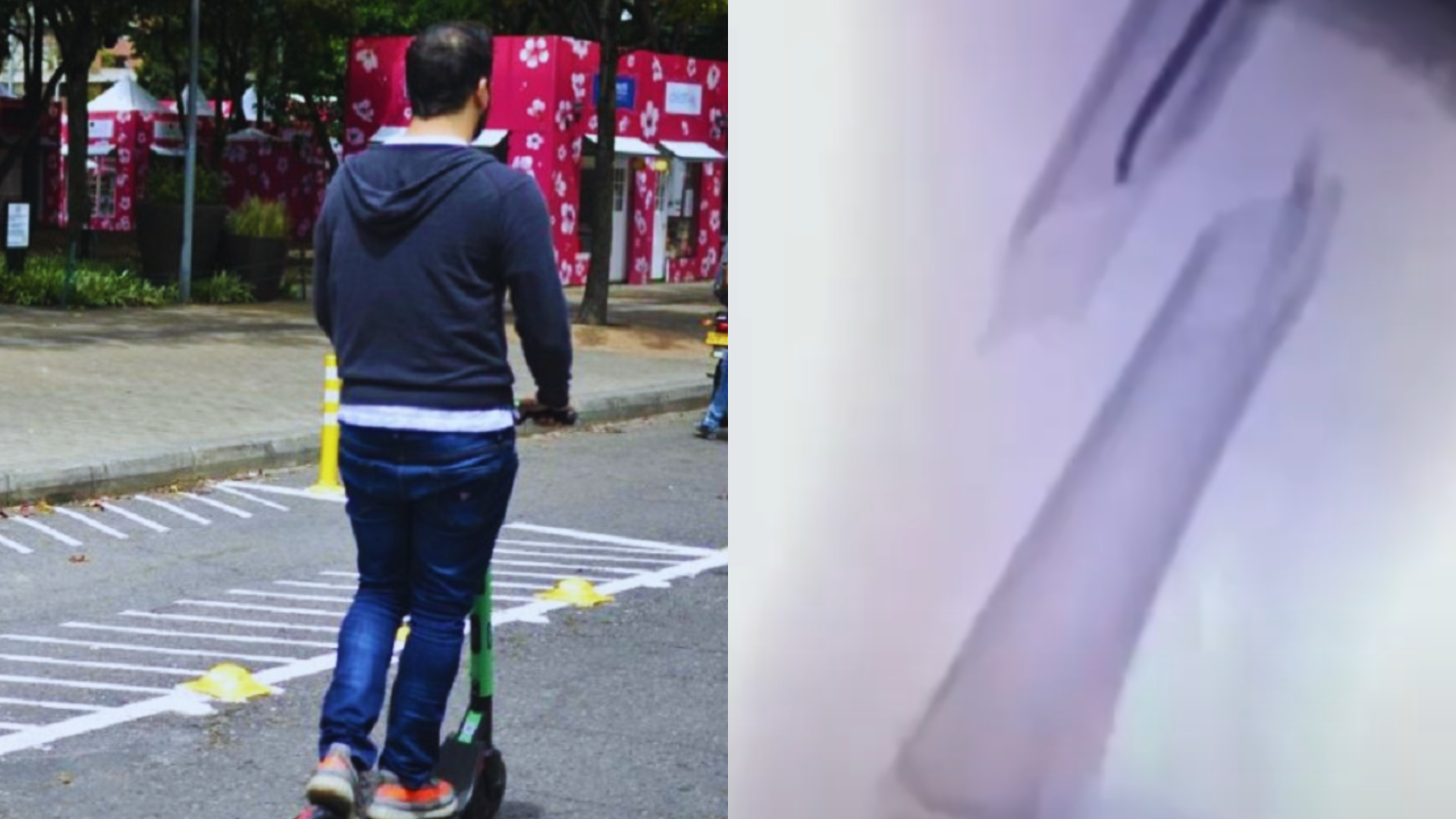 Daniel Pérez aclaró que el niño sufrió una fractura en el fémur.