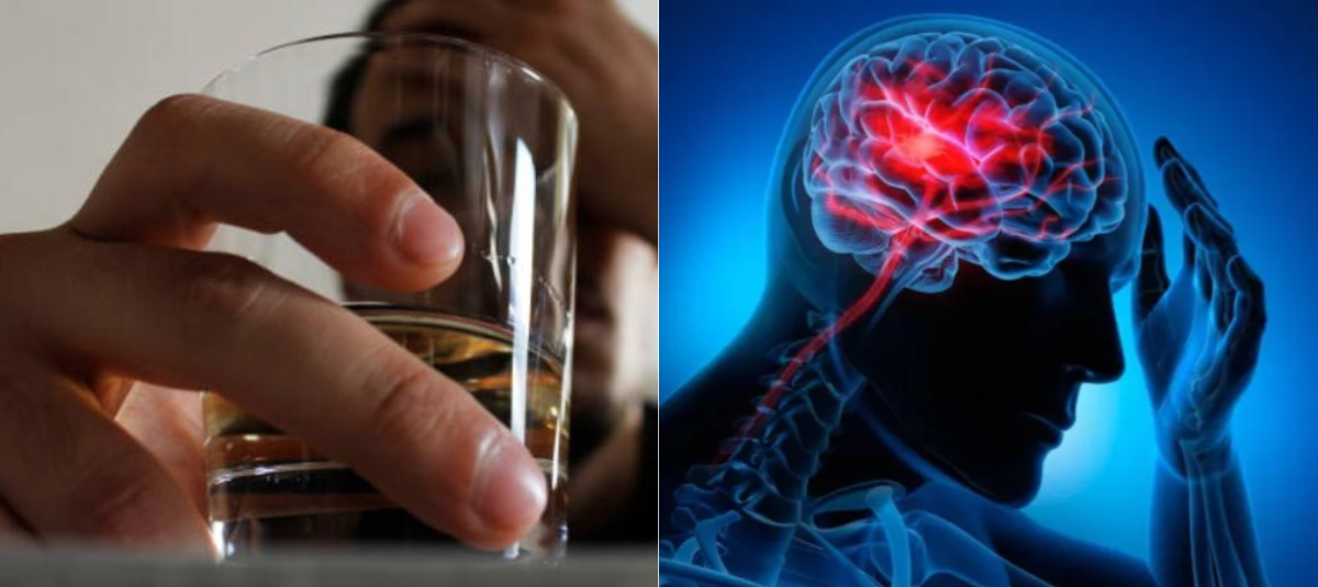 Beber en exceso puede adelantar un ataque cerebrovascular más de 10 años y dificultar la recuperación, según estudio de Harvard