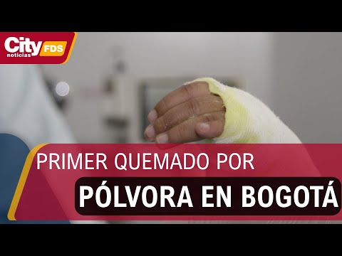 Primer quemado por pólvora en Bogotá: mujer de 33 años resultó lesionada en Usme