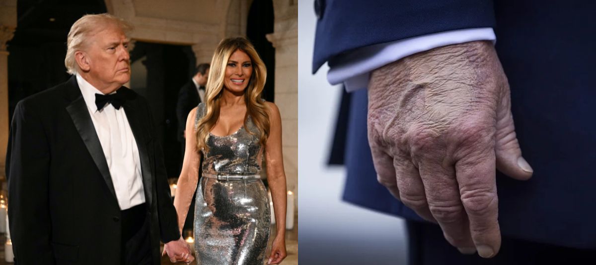 Un video reavivó las especulaciones sobre la salud de Trump, alimentadas desde el año pasado por reportes médicos inconclusos y moretones en sus manos.