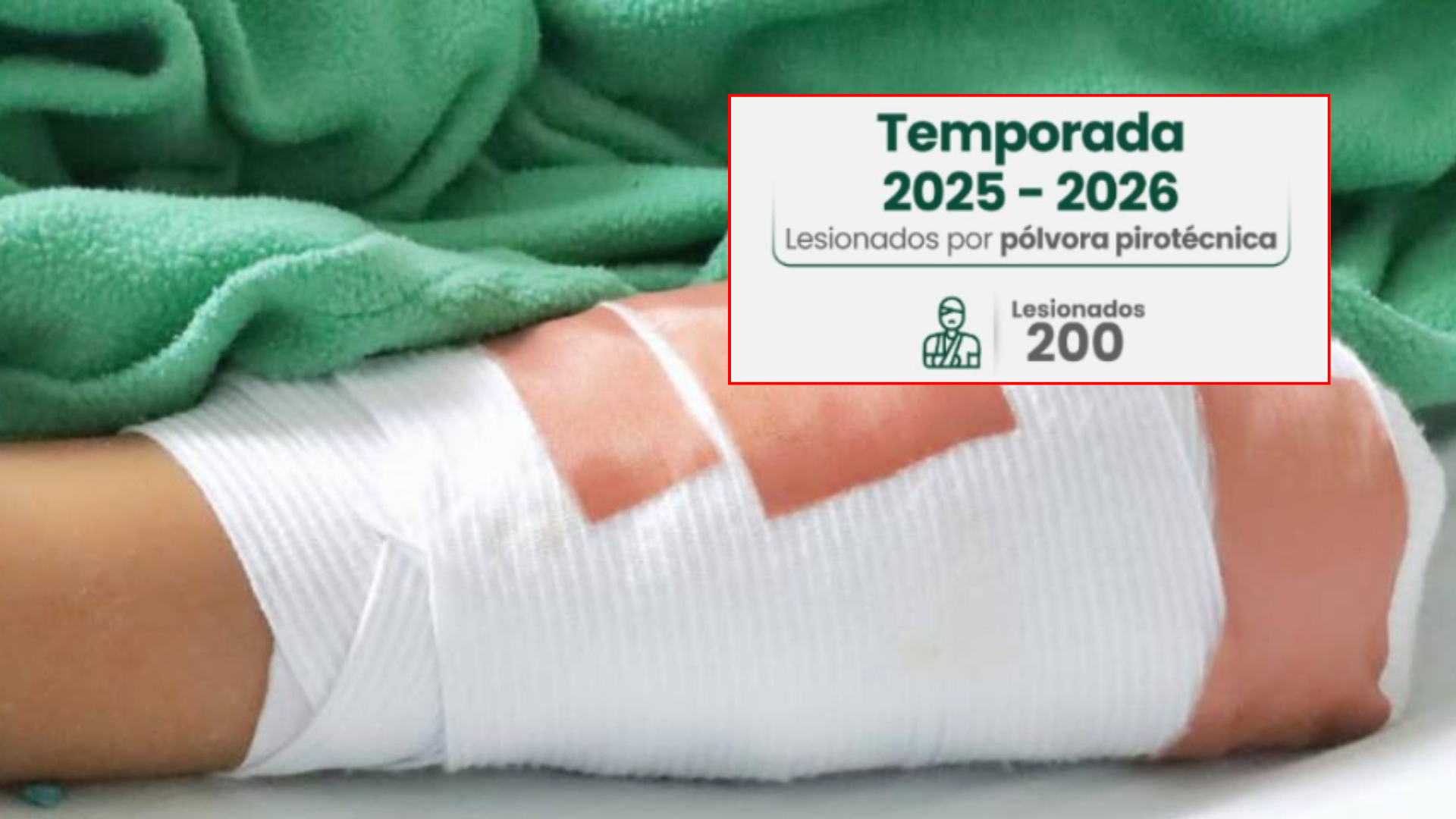 Antioquia llegó a los 200 casos de quemados en el marco de la temporada de fin de año.