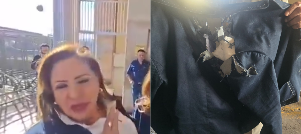 El explosivo detonó muy cerca de su cabeza.