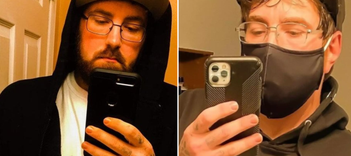 Hombre que dice tener el pene más pequeño del mundo