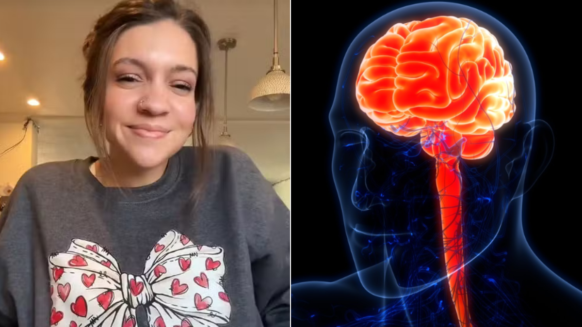 Mujer sufrió un ACV después de estirarse el cuello