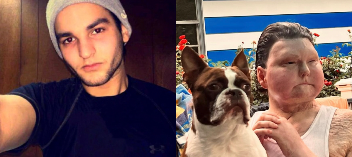 El joven, que entonces llevaba una vida activa y muy ligada al deporte, comenzó allí un largo camino médico y personal.