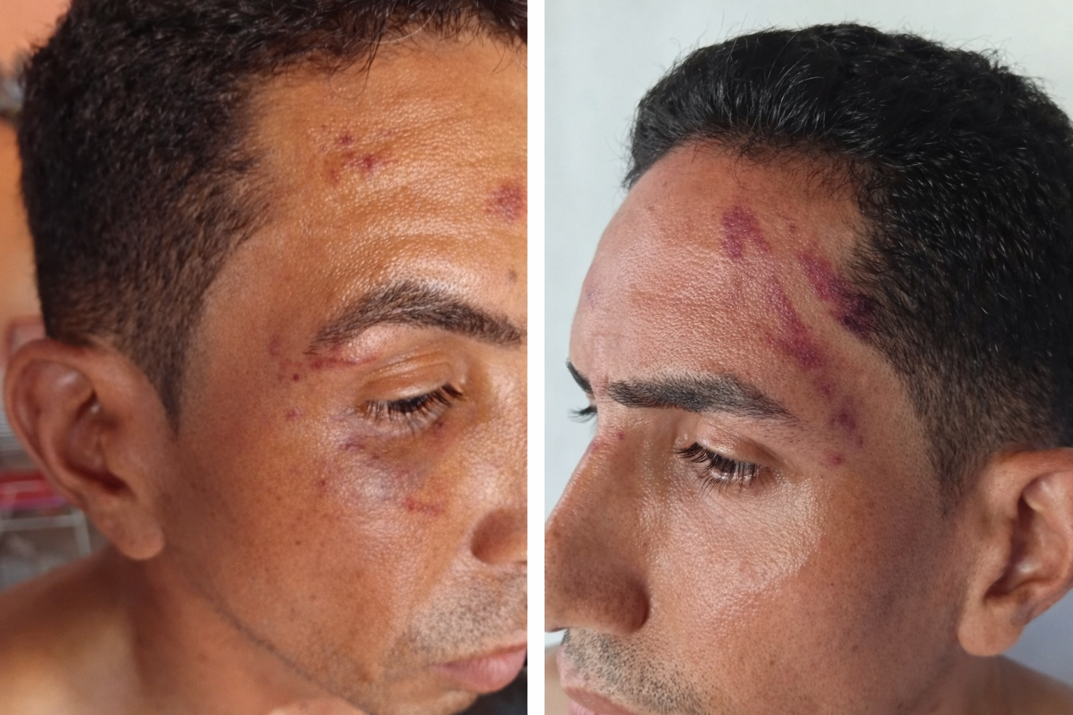 Hombre víctima de golpiza en Cartagena