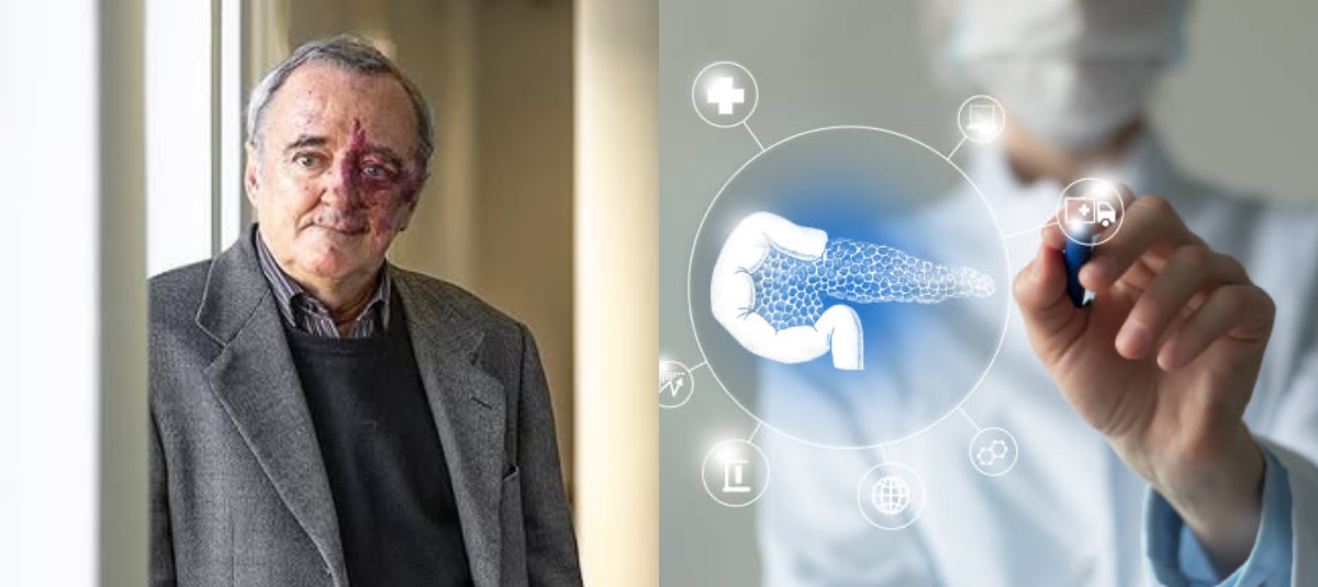 Cáncer de páncreas