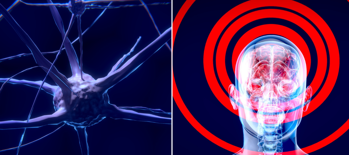 Altos niveles de estrógeno