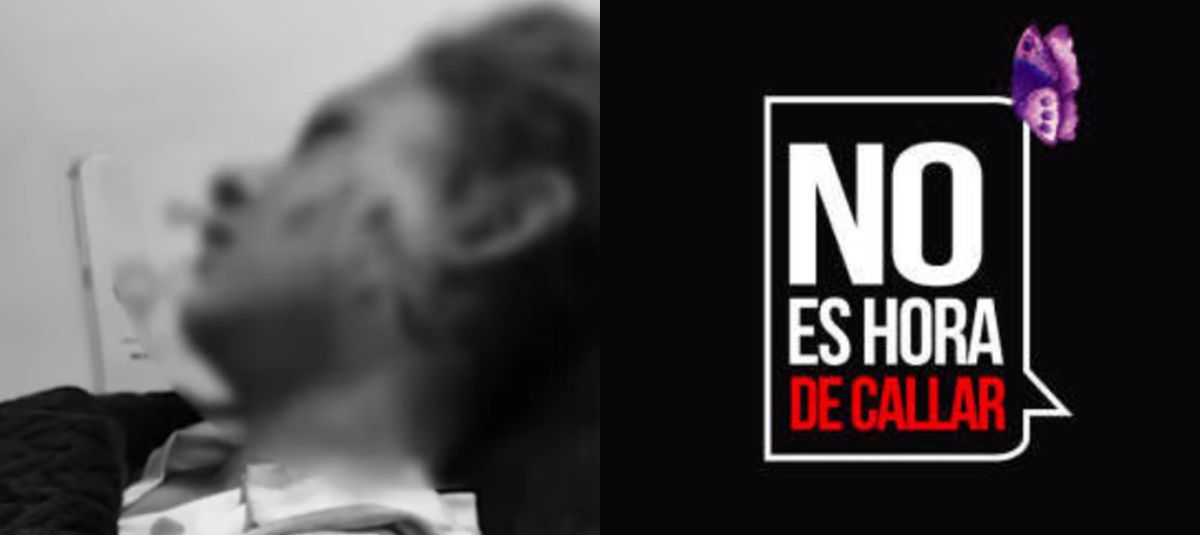 Menor fue golpeada por un hombre en Bogotá.