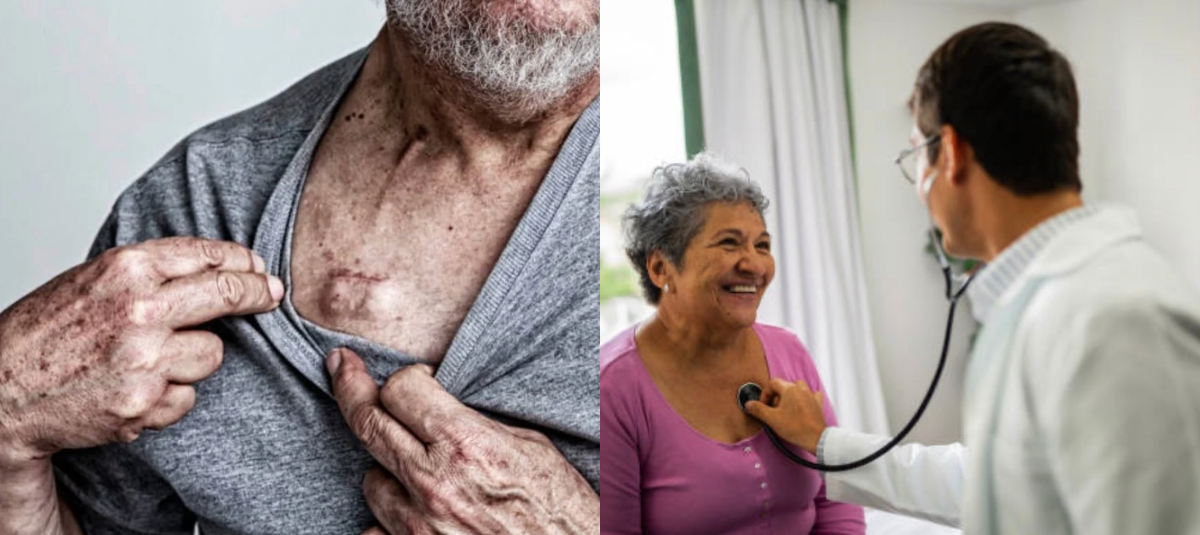 El procedimiento, que utiliza tecnología de la compañía Abbott, refuerza la disponibilidad de alternativas para pacientes en fase terminal