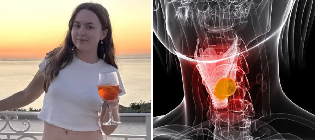 Joven de 22 años padece cáncer.