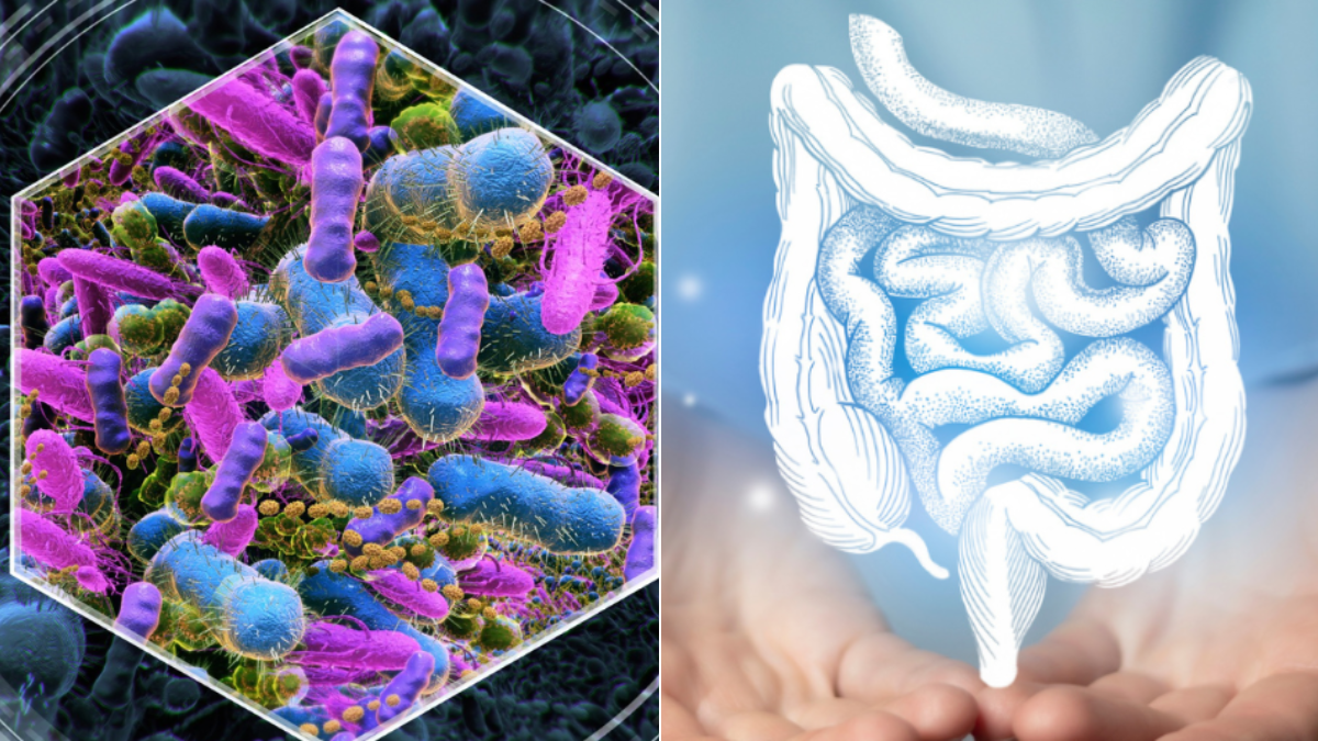 Intestinal