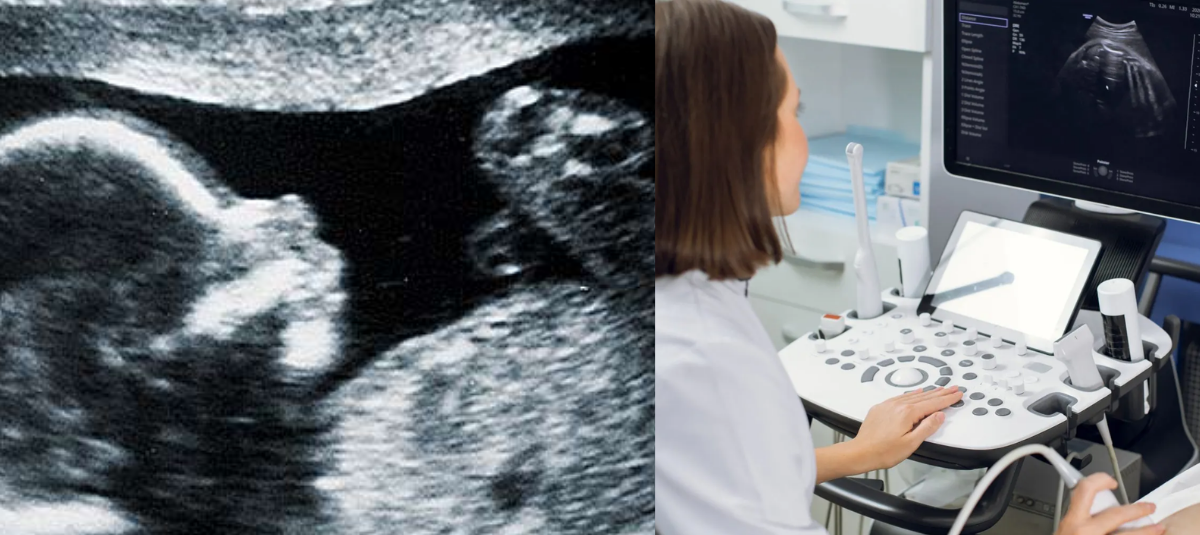 Médico italiana fue condenada por no detectar una malformación fetal: tendrá que pagar más de 600 millones de pesos a la familia afectada