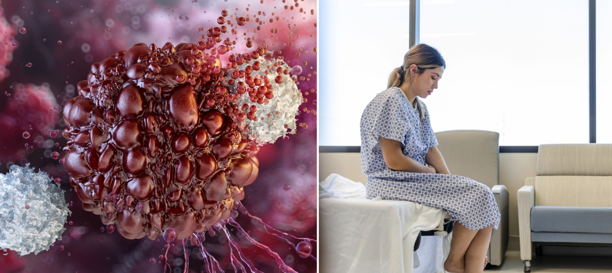 Enfermedad camaleón.