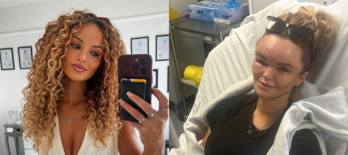 Profesora británica afectada por angioedema hereditario.